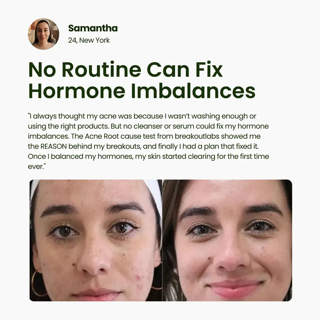 BreakoutLabs Acne Root Cause Test BreakoutLabs