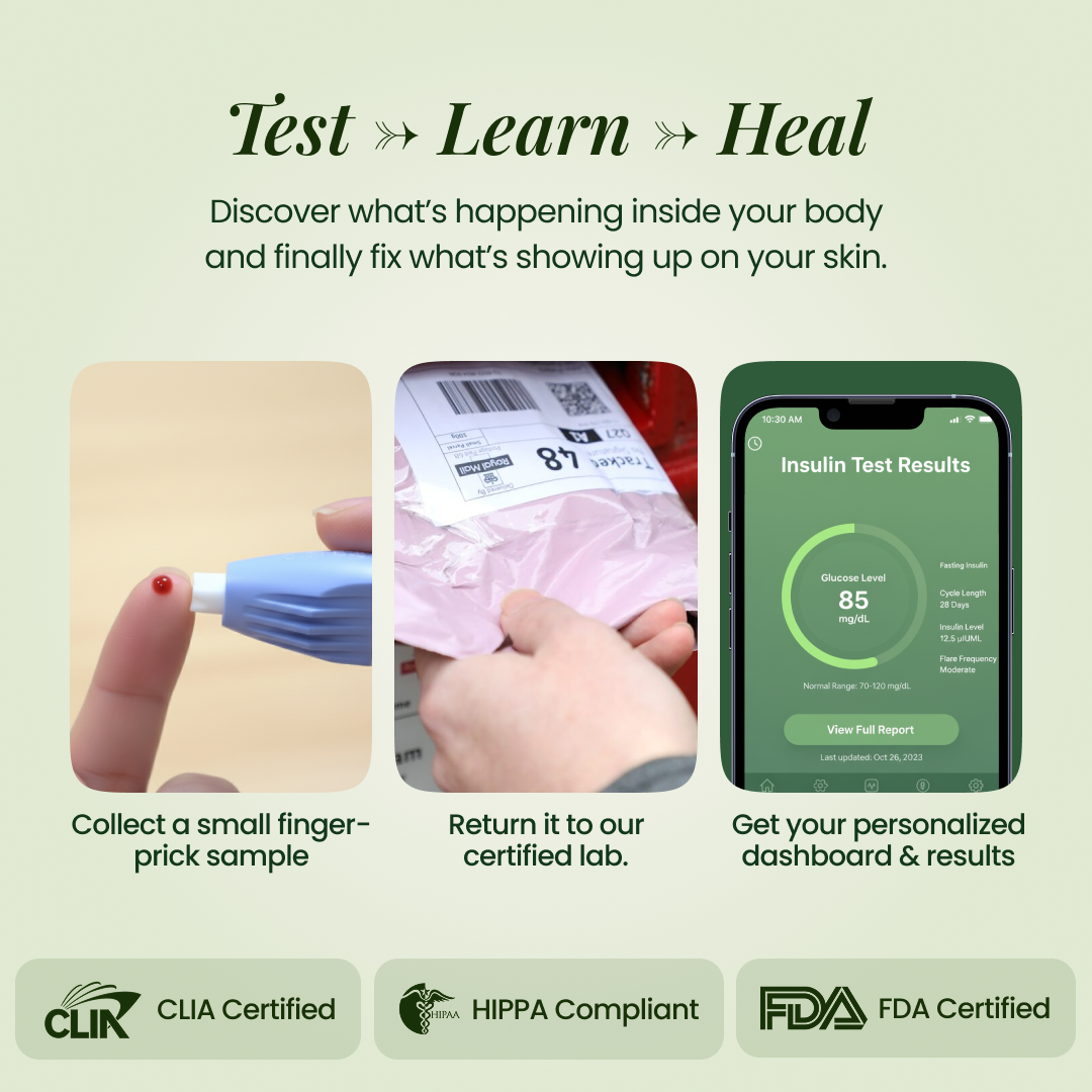 BreakoutLabs Acne Root Cause Test