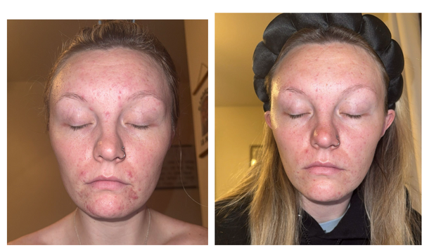 Steph O. | Verified Customer