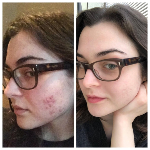 Jessica G. | Verified Customer