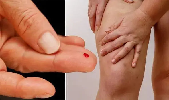 How Blood Sugar Affects Your Skin - BreakoutLabs