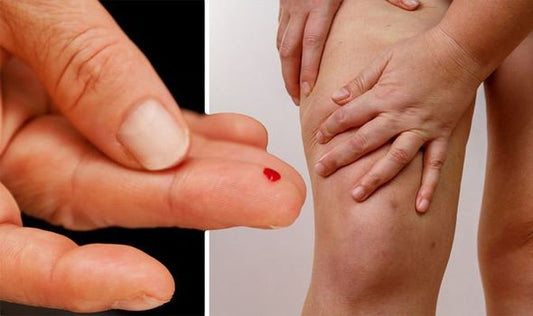 How Blood Sugar Impacts Your Skin