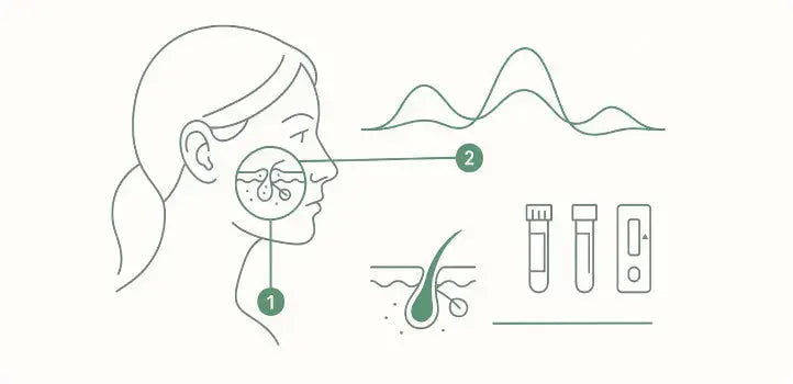 Hormonal Acne Signs, Symptoms, and Testing Options - BreakoutLabs
