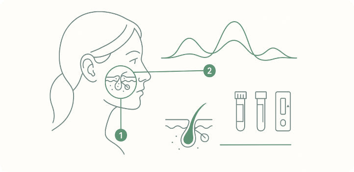 Hormonal Acne Explained: Signs, Symptoms, and Testing Options