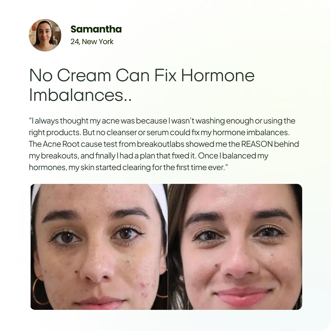 Acne Root Cause Test Kit