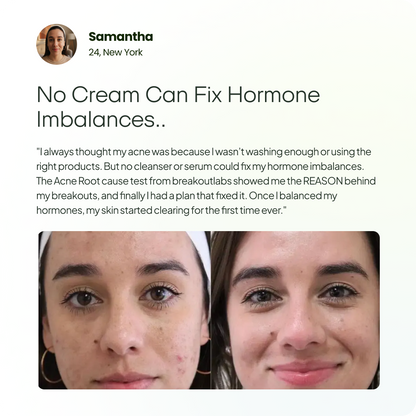 Acne Root Cause Test Kit