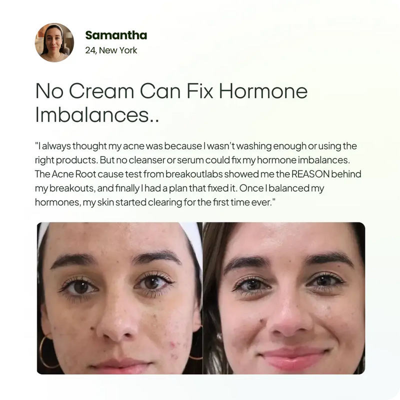 Acne Root Cause Test Kit BreakoutLabs