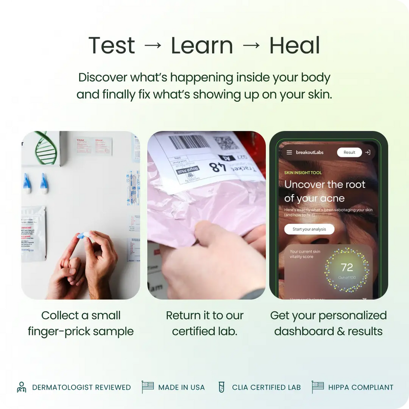 Acne Root Cause Test Kit BreakoutLabs