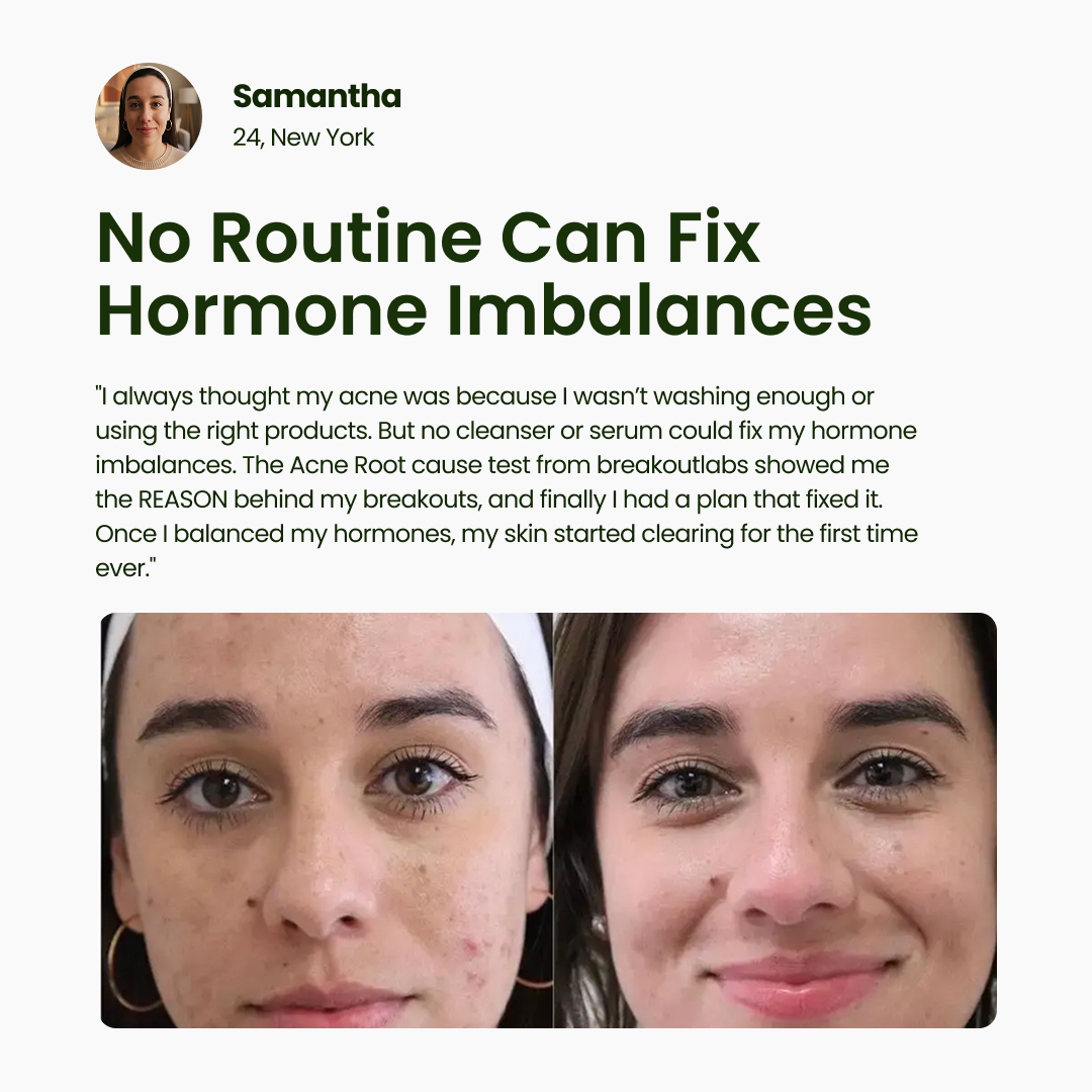 BreakoutLabs Acne Root Cause Test