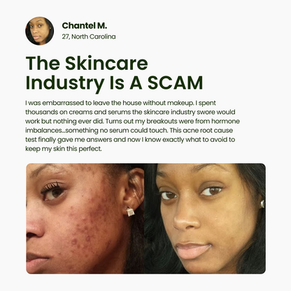 Acne Root Cause Test