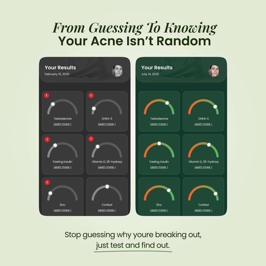 BreakoutLabs Acne Root Cause Test