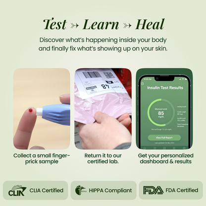 Acne Root Cause Test