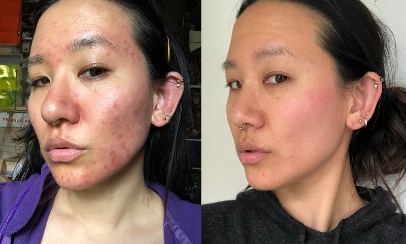 Before and After