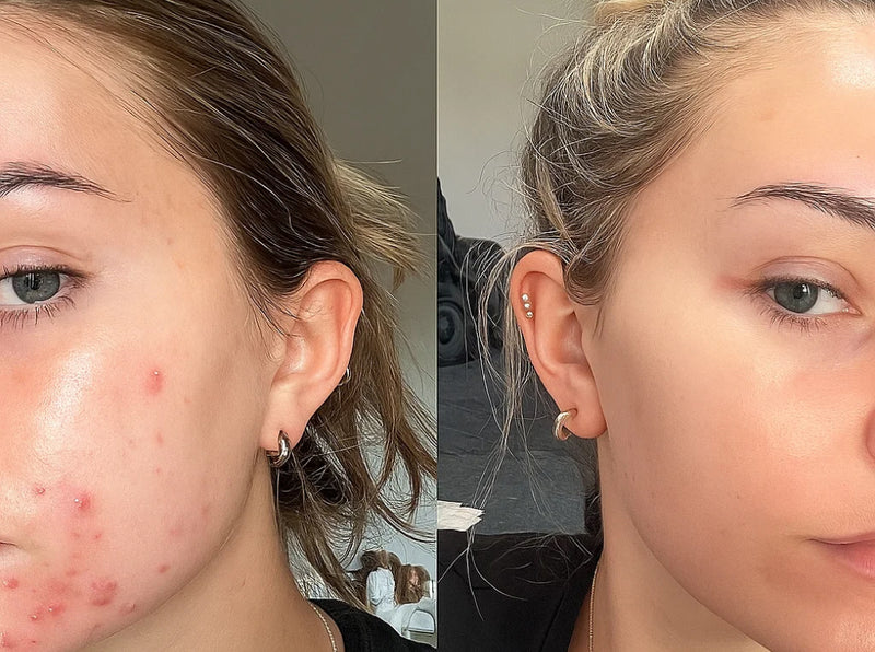 Before and After
