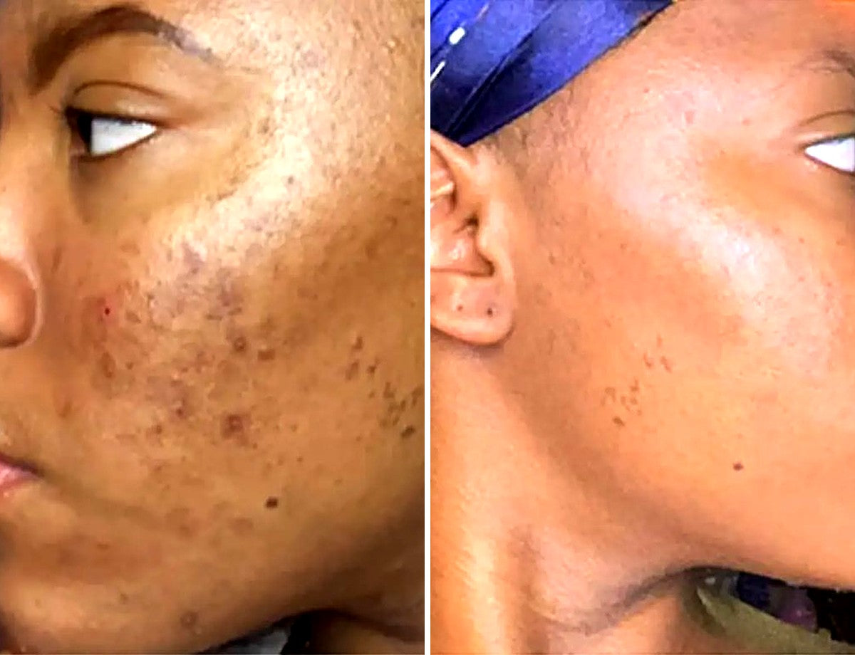 Nicole · Verified member · 8 weeks after testing