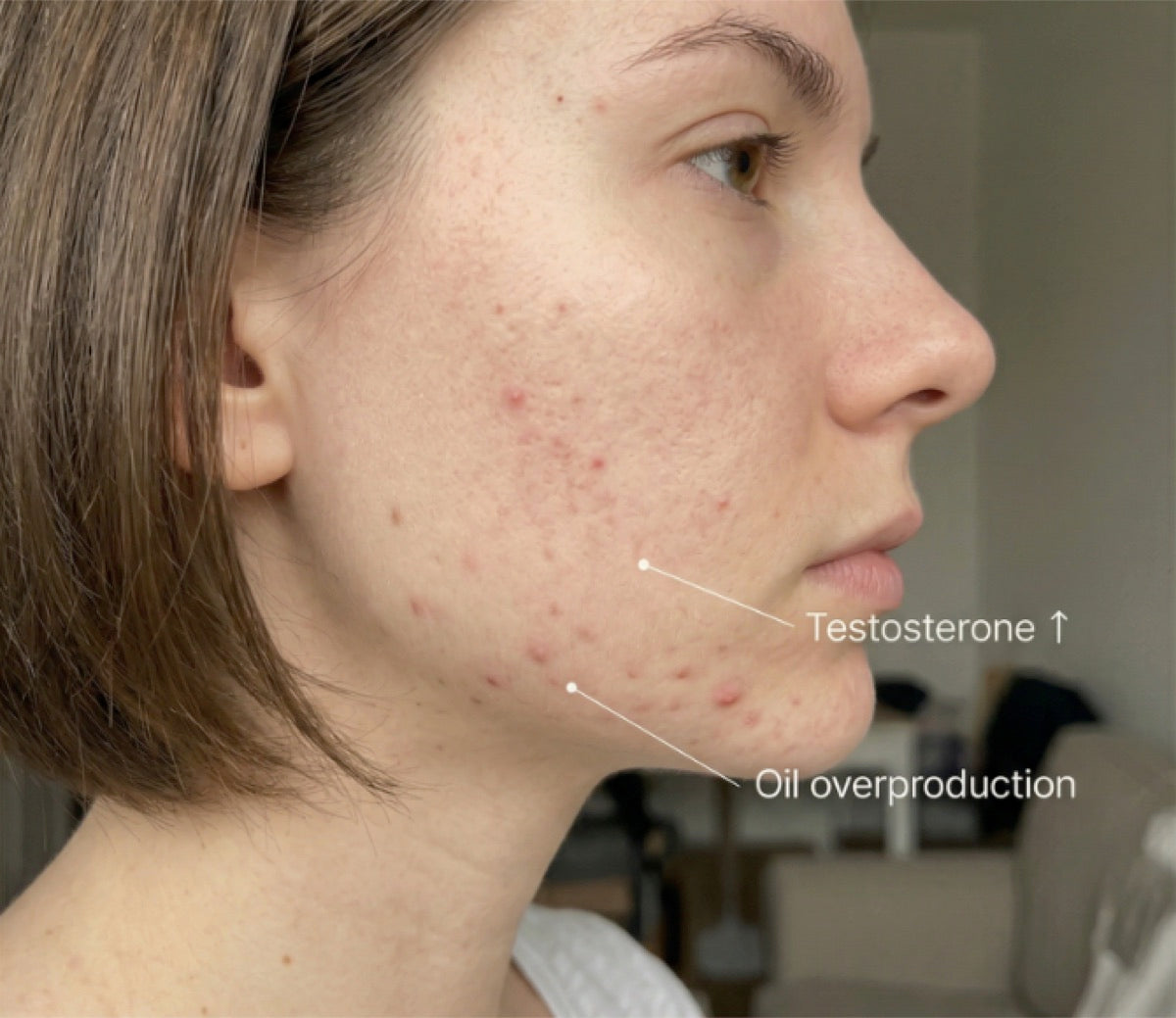 Hormones Are In Overdrive But No One's Testing Them